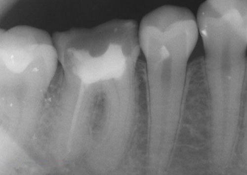 中國再生牙齒研究新進展，重塑微笑，科技引領牙齒再生新篇章