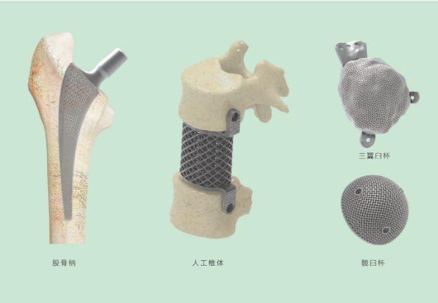 三維打印髖關(guān)節(jié)技術(shù)新動(dòng)態(tài)，重塑生活的科技魔法奇跡