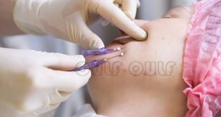 線雕最新手法，背景、發(fā)展、時代地位及展望